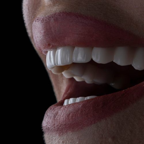 How Veneers Provide Long-Term Value Despite the Initial Price